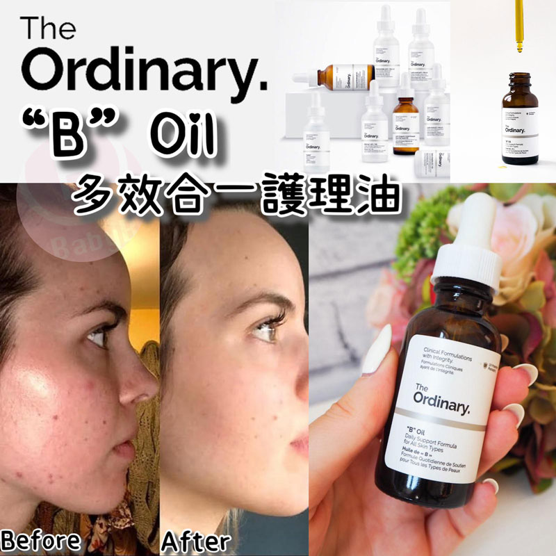 The Ordinary B Oil